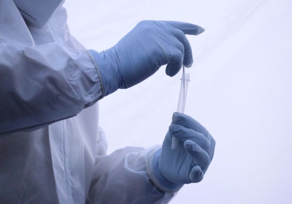 Sin contagios por dengue en Puebla, en las últimas 24 horas: Salud