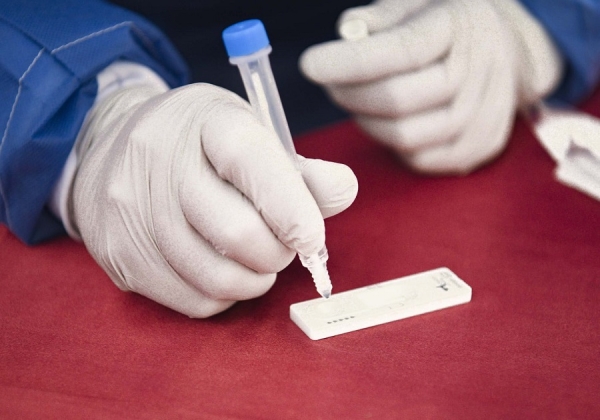 Acumula Puebla 856 casos de dengue: Salud